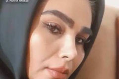 rhinoplasty-158