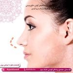 اقدامات قبل از جراحی بینی