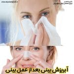 آبریزش بینی بعد عمل - دکتر پریا حامدی