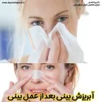 آبریزش بینی بعد عمل - دکتر پریا حامدی